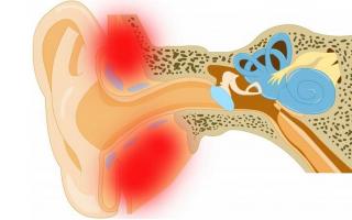 Гиперемия наружного слухового прохода: причины и лечение